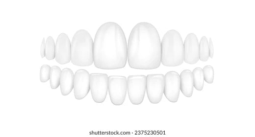 Retainers - Upper & Lower - AlienGuards